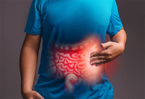 Symptoms of Irritable Bowel Syndrome